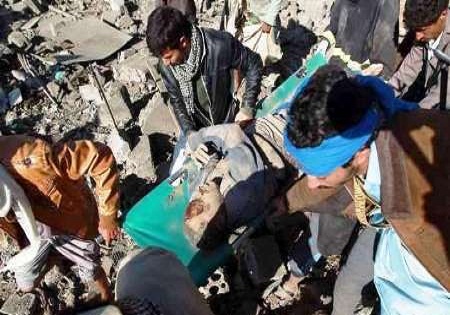 کشته شدن ۶۲ کودک یمنی در حملات عربستان