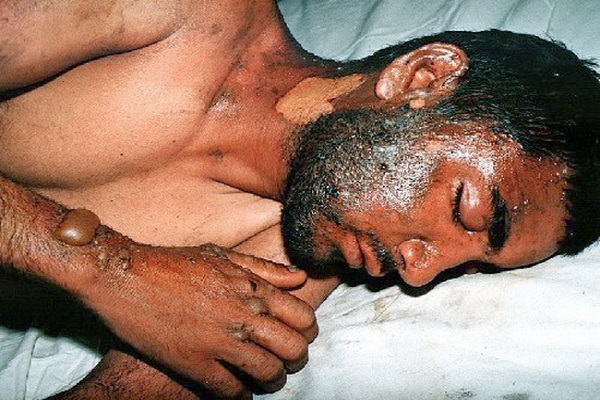 اقدام وحشیانه صدام در سردشت هزاران قربانی گرفت+ تصاویر