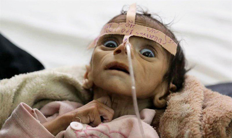 درخواست سازمان ملل برای آتش‌بس انسانی در یمن