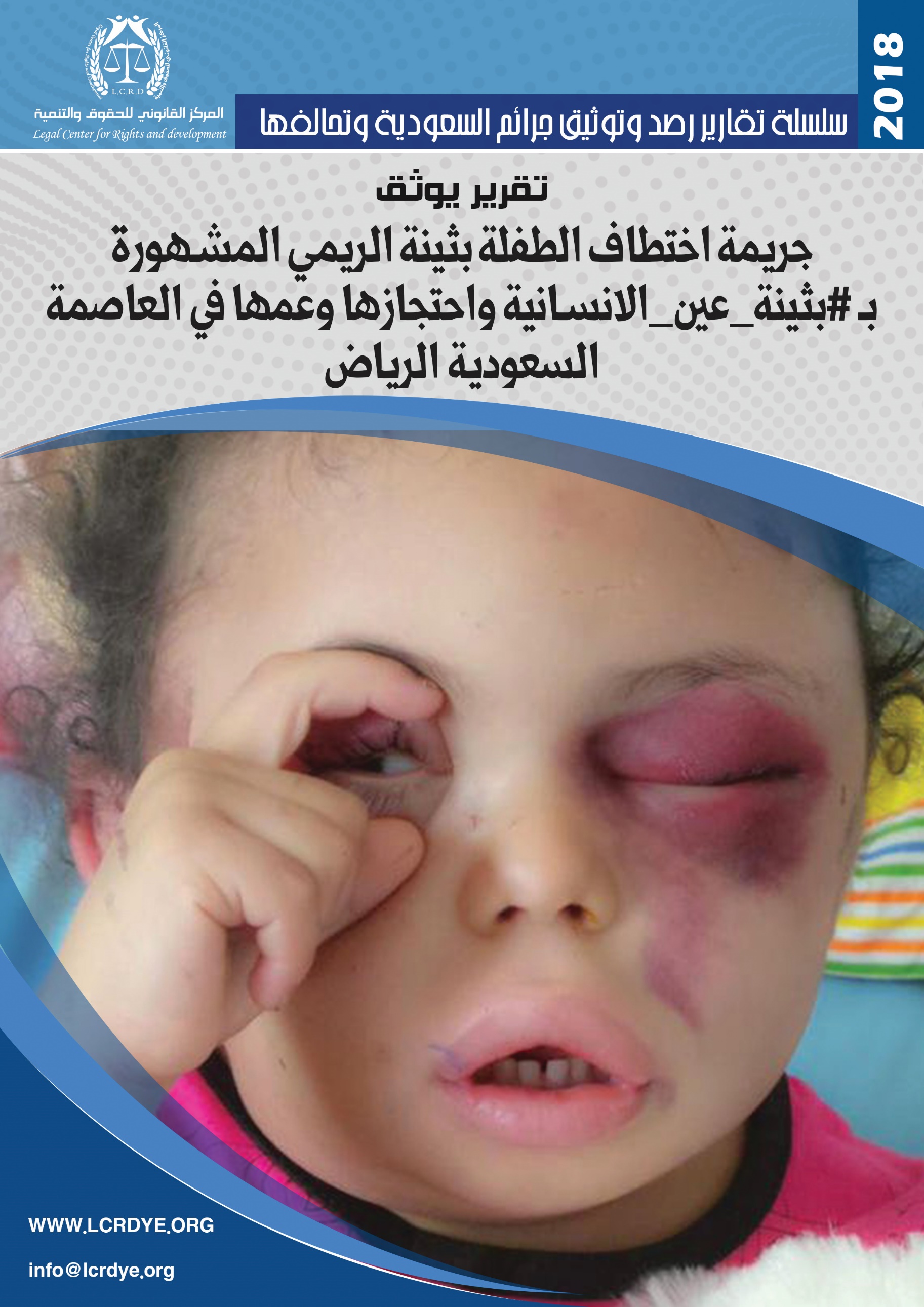 عکس/ بهبودی دختر مشهور یمنی