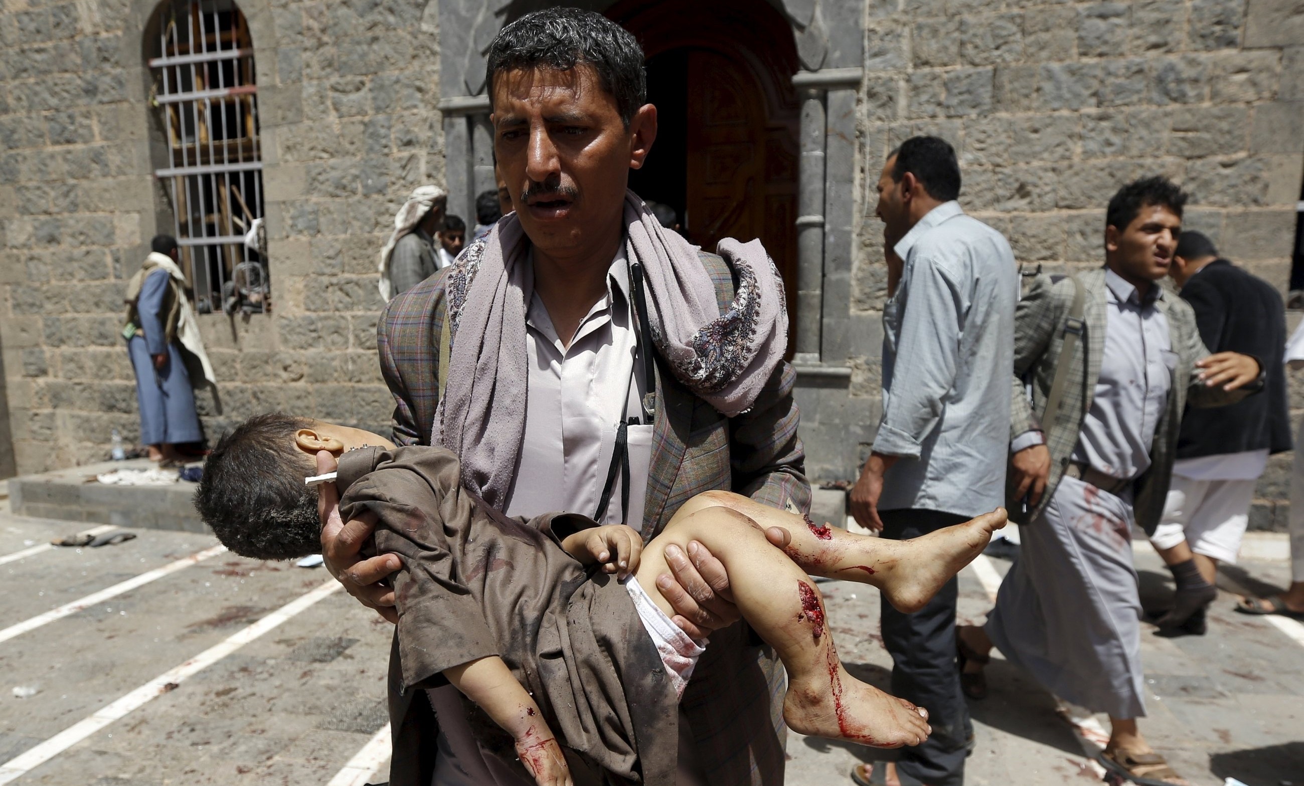 عربستان با بمب کدام کشور کودکان یمنی را به شهادت می‌رساند؟