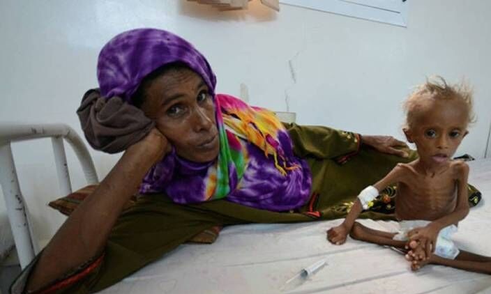 هشدار سازمان جهانی بهداشت: جان میلیون‌ها کودک یمنی در خطر است