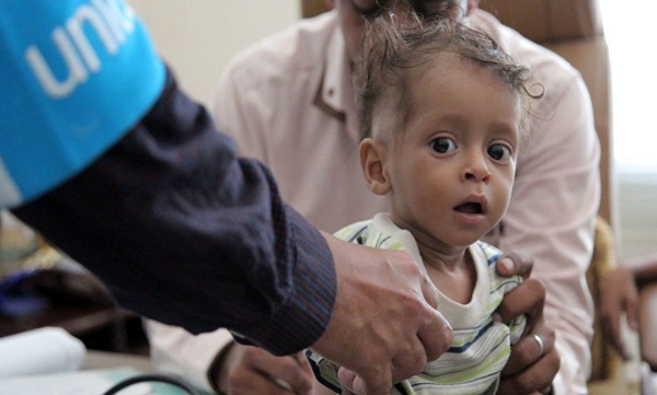 تراژدی مرگ بیماران یمنی بر اثر پیامد‌های جنگ