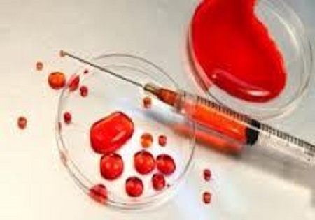 پروژه ای برای پایان دادن به انتظار والدین شهدا
