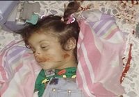 شهادت دختربچه شیعه سوری در حمله موشکی تکفیری ها