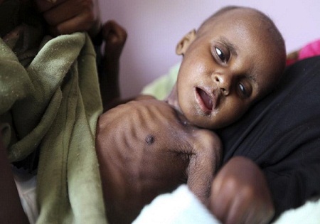 12 میلیون یمنی از دسترسی به مواد غذایی محروم هستند