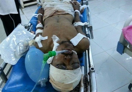 جنایت هولناک آل سعود در یمن/ ۱۵ شهید و زخمی در بمباران یک بیمارستان
