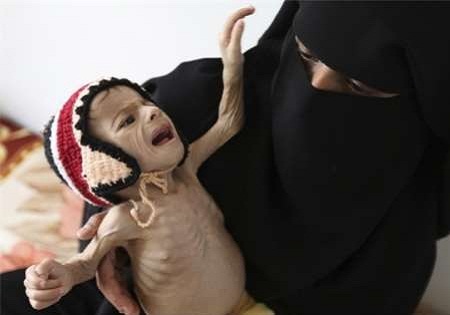 یمن با فاجعه انسانی روبه‌رو است