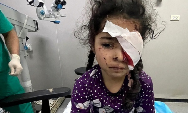 وزارة الصحة الفلسطينية: 1500 فلسطيني فقدوا البصر جراء حرب الإبادة في قطاع غزة
