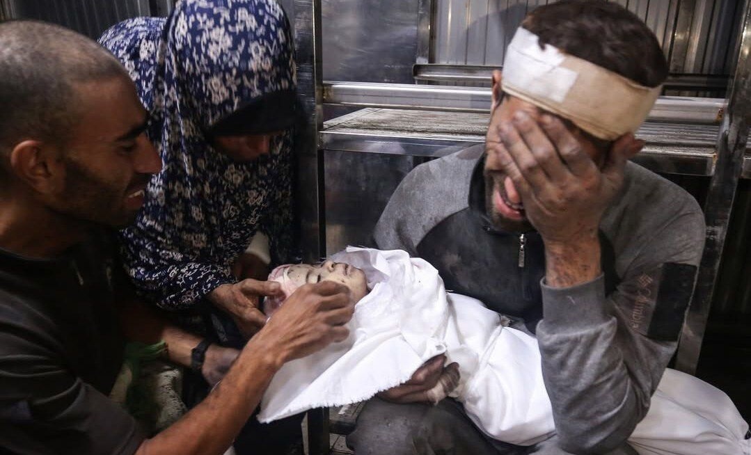 وزارة الصحة بغزة: ارتفاع عدد شهداء المجاعة وسوء التغذية إلى 217 شخصا في قطاع غزة