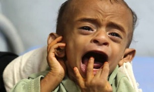 Millions Dying as UN’s Humanitarian Assistance Remains A Daunting Challenge in Yemen