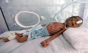 Malnourished Baby Boy Pictured in Yemeni Hospital in Sana’a
