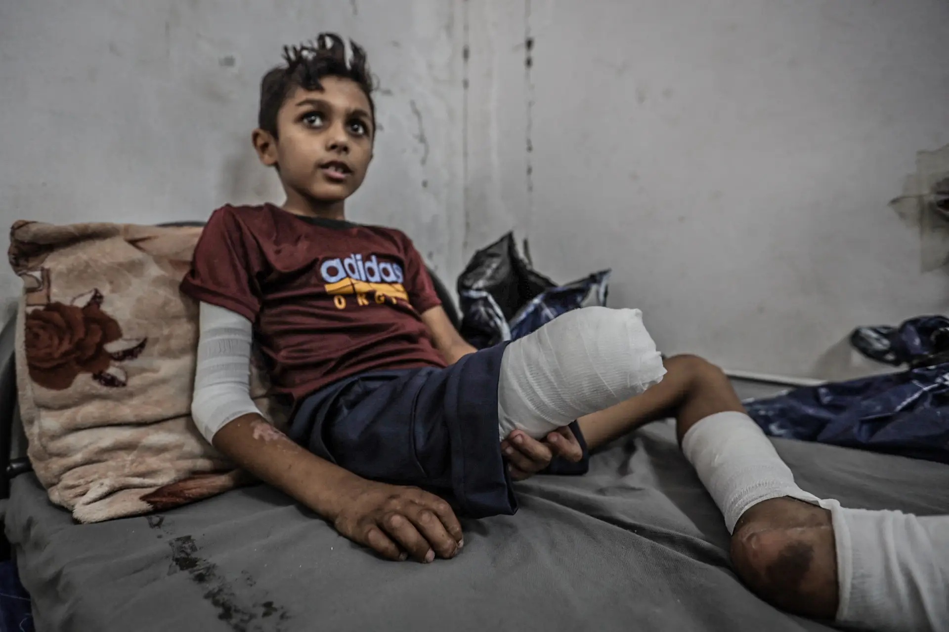 Thousands of Amputations in Gaza Await Rehabilitation Services