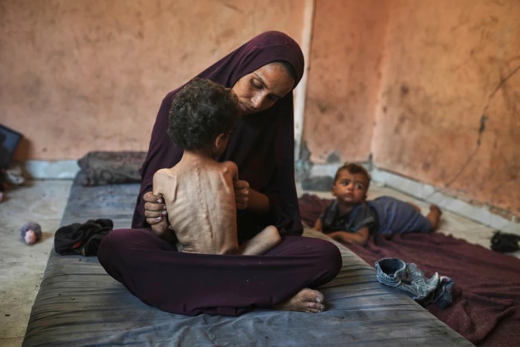100 Children Martyred of Starvation in Gaza
