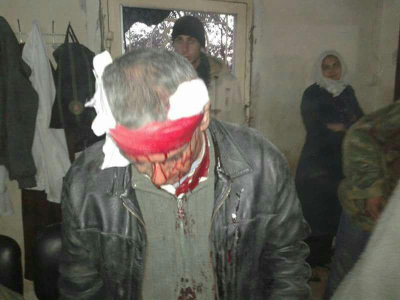 حمله وحشیانه تروریست‌ها به محاصره شدگان مظلوم فوعه و کفریا+ تصاویر