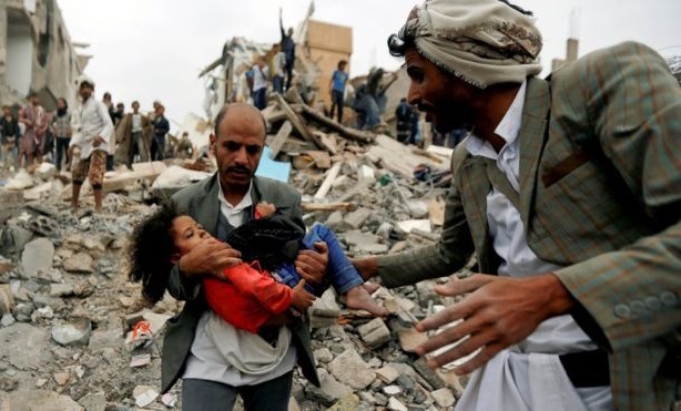 فرانسه 38 یمنی را کشته یا زخمی کرد