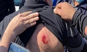 زخمی شدن عضو عرب کنست در حمله پلیس صهیونیستی به تظاهرات فلسطین اشغالی