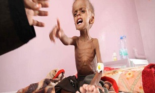 سؤال مجری الجزیره از سعودی‌ها: با پول موشک پاتریوت چند کودک یمنی می‌توان نجات داد؟