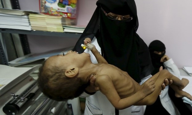 هشدار نهادهای امدادی بین‌المللی درباره کمبود مواد غذایی در یمن