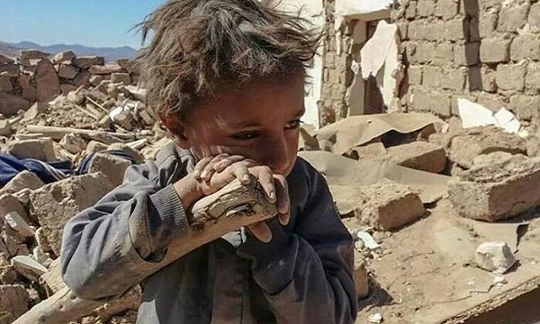 جنایت فراموش نشدنی آل سعود علیه کودکان مظلوم یمنی!