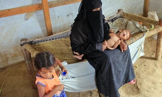 سازمان‌ملل: یک میلیون زن باردار یمنی در خطر سوءتغذیه شدید قرار دارند