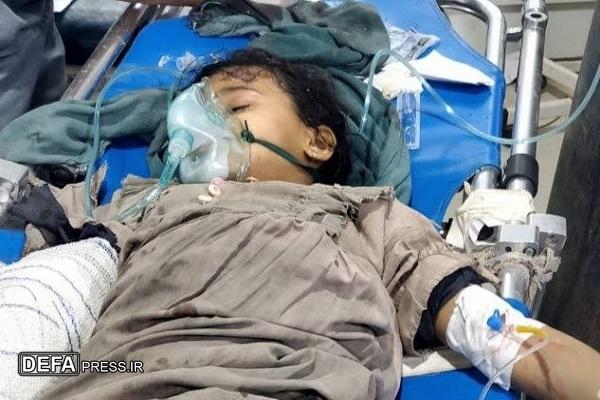 تصاویری دلخراش از کودکان یمنی که در حمله آمریکا شهید شدند