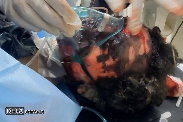 تصاویری دلخراش از کودکان یمنی که در حمله آمریکا شهید شدند