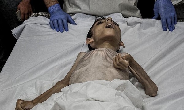 ۳۰ کودک فلسطینی به دلیل گرسنگی در غزه به شهادت رسیدند