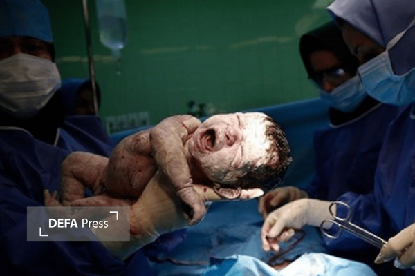 نجات مادر باردار از مرگ حتمی پس از ۱۰ ساعت جراحی پیچیده در بیرجند نجات مادر باردار از مرگ حتمی پس از ۱۰ ساعت جراحی پیچیده در بیرجند