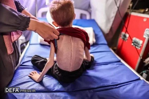 وزارت بهداشت غزه از ۵۷ شهید بر اثر گرسنگی مفرط در غزه خبر داد