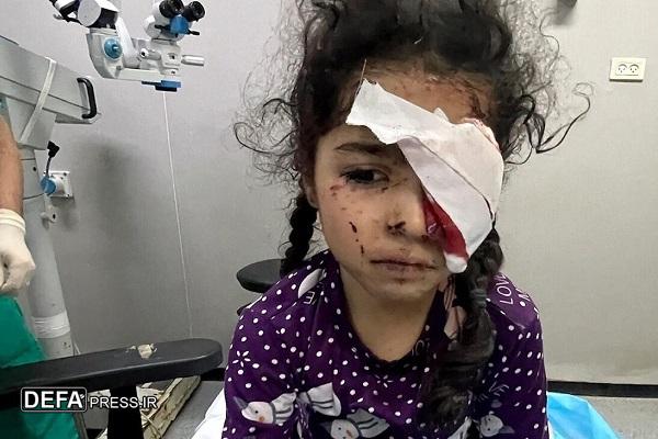 جنگ غزه موجب نابینایی ۱۵۰۰ فلسطینی شده است
