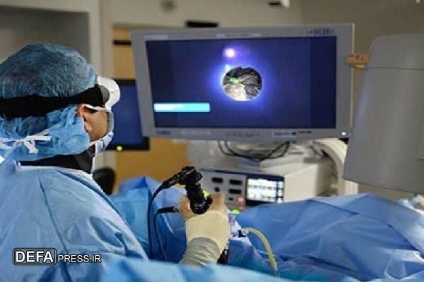 اولین عمل سنگ‌شکنی کلیه به روش پیشرفته در مریوان کردستان انجام شد