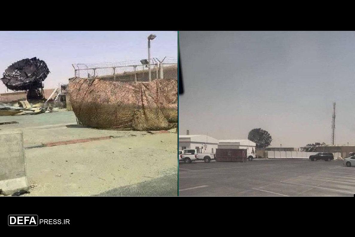 شلیک به چشم آمریکا 