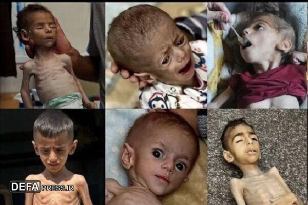 مدیر امداد پزشکی از وخامت اوضاع بهداشتی در غزه خبر داد