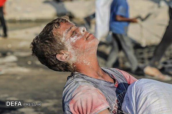 فریاد گرسنگی کودکان غزه در سایه سکوت مدعیان حقوق بشر