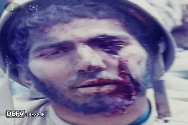 سرباز شهیدی که با چشم ترکش خورده، 6 شبانه روز نخوابید