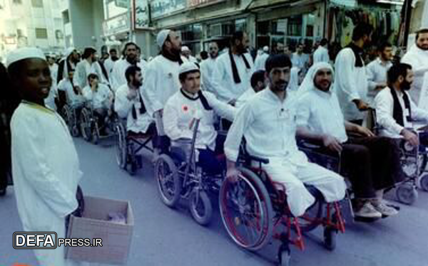زندگی عادی یک جانباز با دو پا و یک دست قطع‌شده