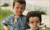 شیمیایی و سردشت،ظالم و مظلوم در جنگ